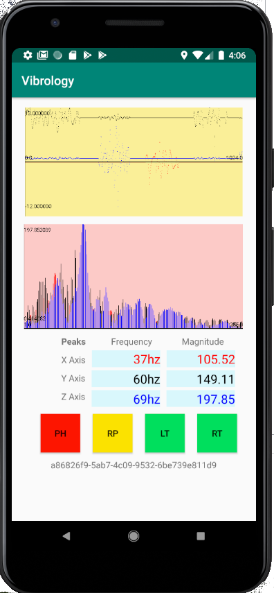 The Vibrology App exclusively for Android. A Fast Fourier Transform Analyis for Low Frequency Signals
